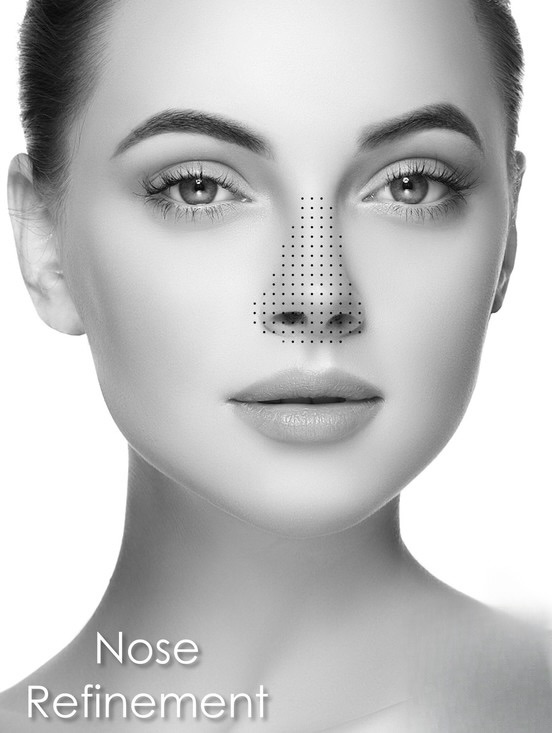 Facetune-nose-refine