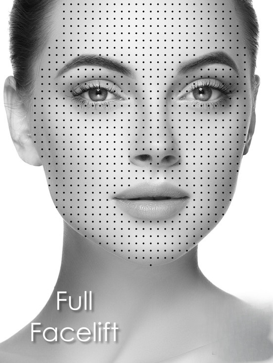 Facetunefull-facelift